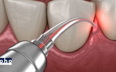 Unlocking the Future of Periodontal Health: Embracing the LANAP Revolution