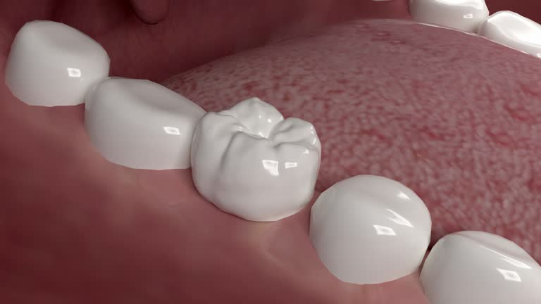 tooth with a dental crown