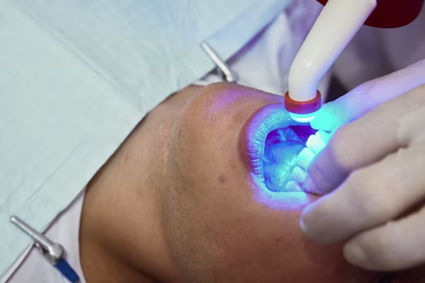 a photo showing dental whitening treatment