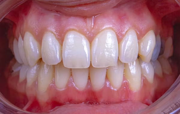 close-up shot of a person's teeth